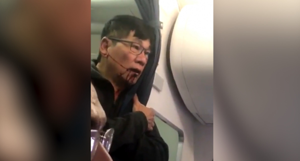 Here’s how to avoid a United incident at your company – SPECIAL PODCAST
